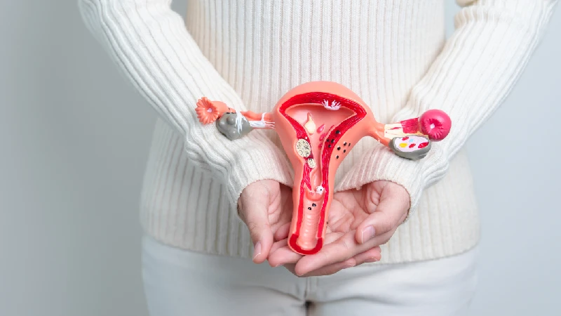 Žena drži model ženskog reproduktivnog sistema, ilustracija teme PMOS i promena naziva sindroma policističnih jajnika (PCOS), sa fokusom na hormone, reproduktivno zdravlje i menstrualni ciklus.