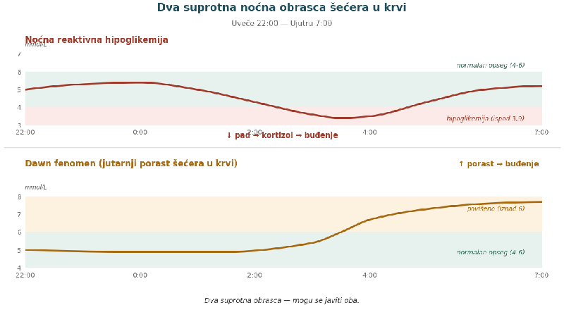 Noćna reaktivna hipoglikemija i dawn fenomen – dva suprotna obrasca šećera u krvi koja izazivaju buđenje u ranim jutarnjim satima